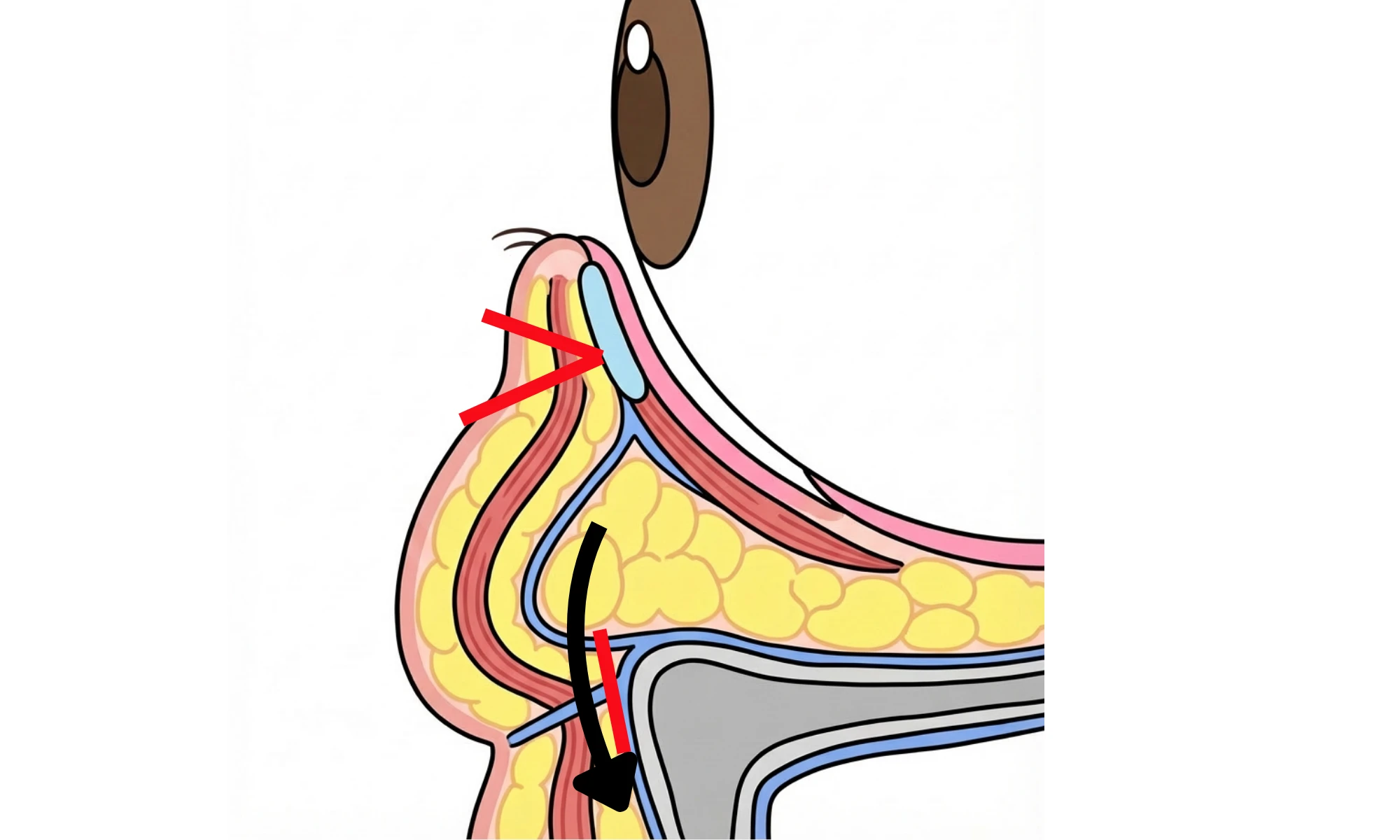 omote hamura overview